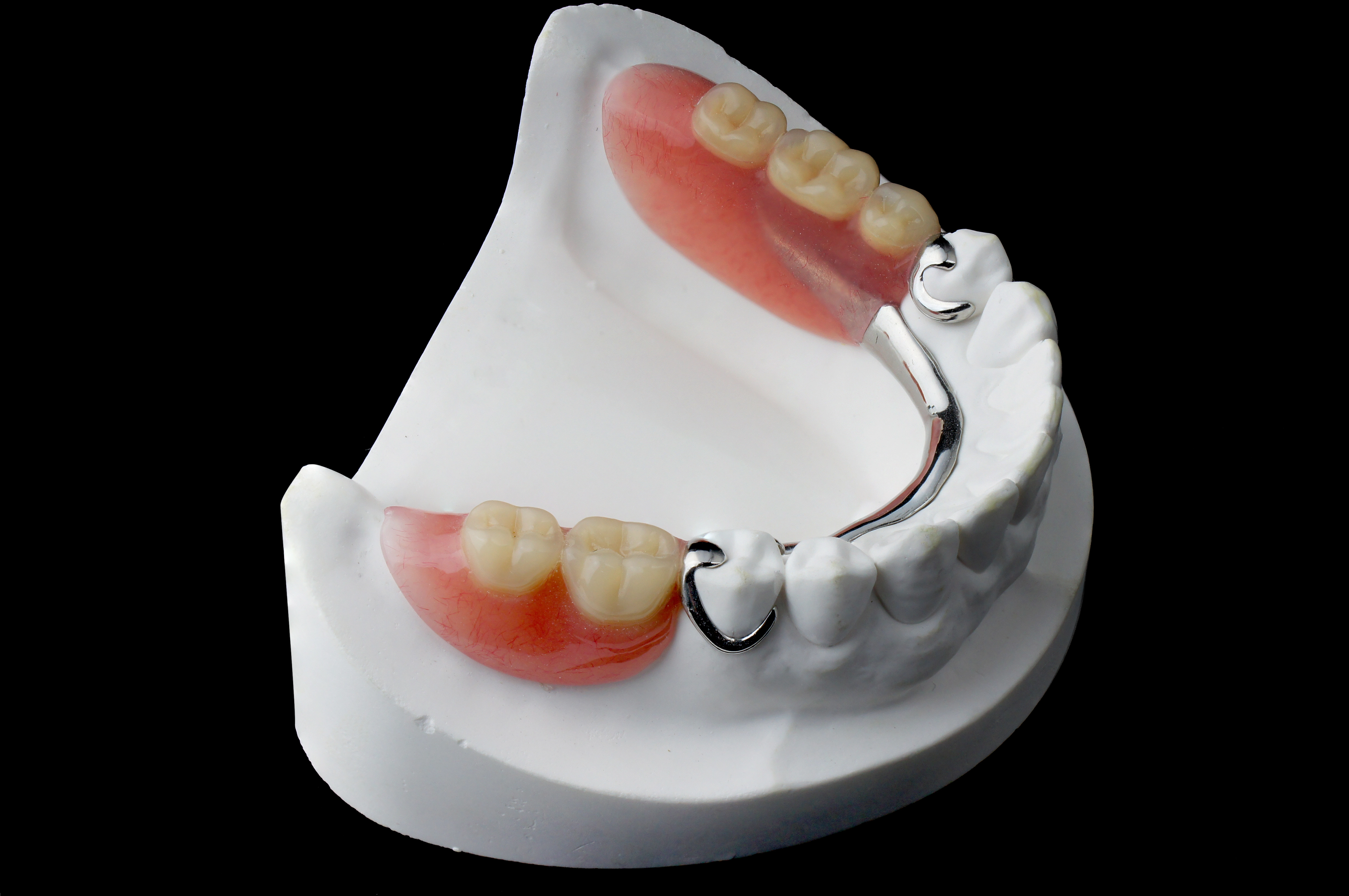 Removable Denture (RPD) at Apex Dental Care Bhadrak