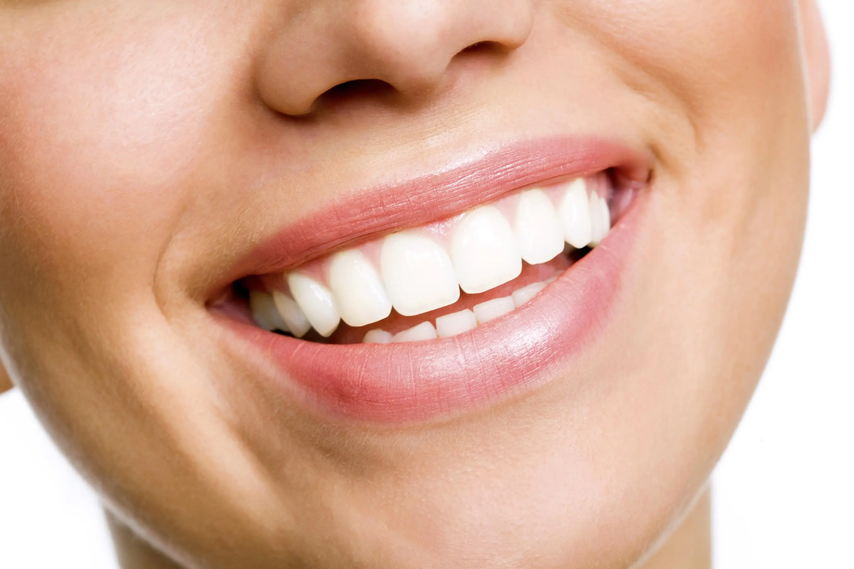 Teeth whitening smile makeover